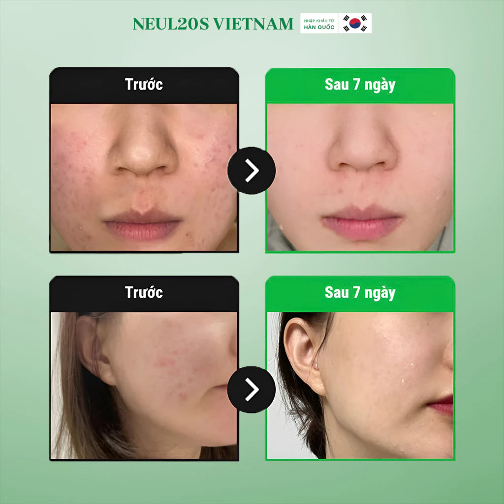 Sữa Rửa Mặt Sạch Sâu, BHA Hỗ Trợ Tẩy Tế Bào Chết, Kiềm Dầu Cho Da Mụn Nhạy Cảm Neul20s Spicule Cica Foam Cleanser 100mL